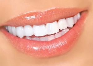 Белые зубы за 1 день!